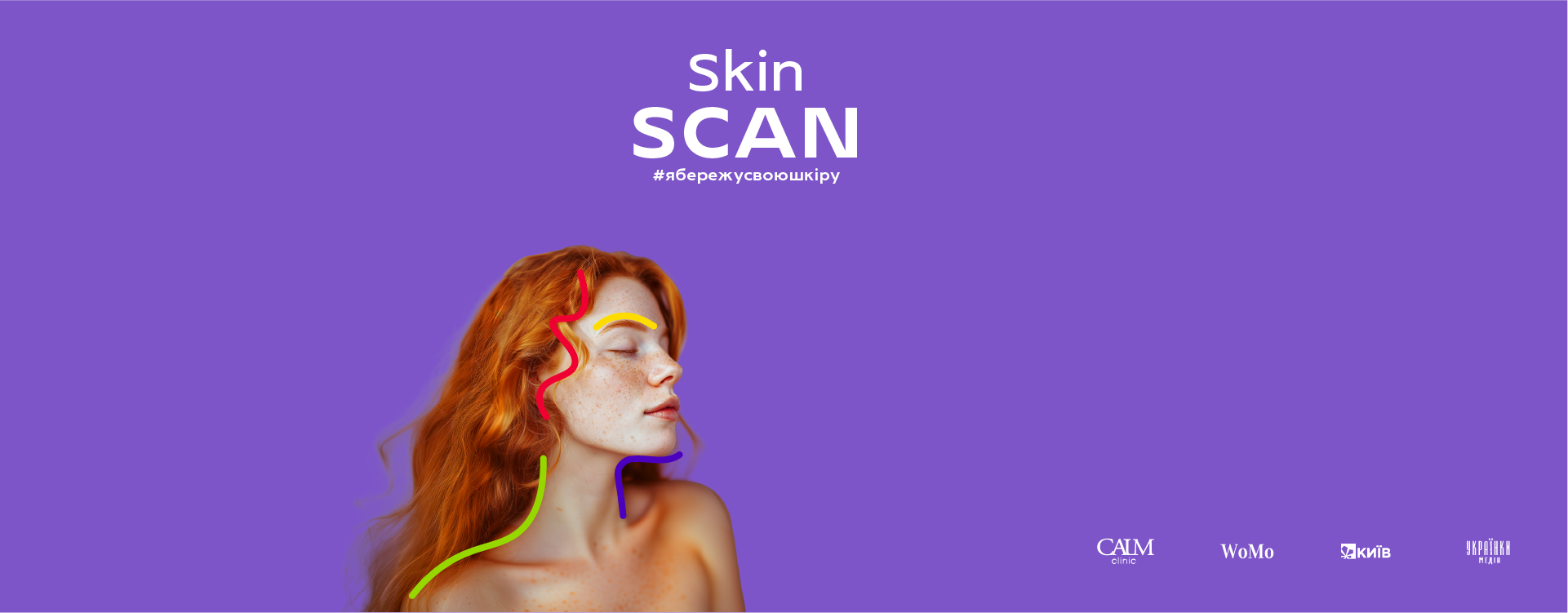 Діагностика родимок в рамках проєкту SkinScan